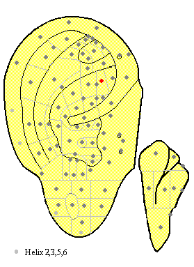 Bladder MA65 Bladder MA65