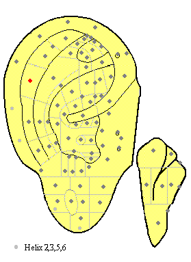 Elbow MA13 Elbow MA13