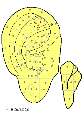 Middle Triangular Fossa MA32