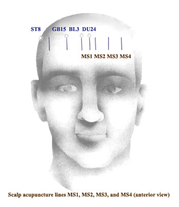HEAD1.jpg