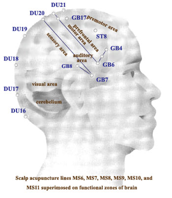 HEAD6.jpg